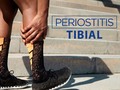 La periostitis es la inflamación aguda del periostio o de la membrana de tejido que cubre el hueso, por lo general, se suele dar en la tibia y la zona más afectada va a ser el área situada entre el músculo tibial posterior y el sóleo.  El músculo tibial posterior es un músculo cuya acción principal es la supinación, es decir, orientar la planta del pie hacia adentro, lo que supone una importante acción para el mantenimiento del equilibrio y la postura por esta razón las personas que más habitualmente sufren esta patología son aquellas en las que el pie se encuentra en pronación (la planta del pie se orienta hacia afuera). Las personas que más frecuentemente están afectadas de la periostitis son, en la gran mayoría de los casos, son los corredores o los velocistas; ya que usan esta estructura posterior de la tibia en exceso, aunque, de manera general, también afecta a personas que practican otros deportes.  Algunos de los factores que dan lugar a la periostitis son: -Entrenamiento excesivo e intenso. -Calzado inadecuado. -Correr en bajada. -Terreno de juego muy difícil (por ejemplo campos de fútbol muy embarrados tras una lluvia). -Obesidad.  El dolor comienza a baja intensidad y poco a poco va creciendo hasta hacerse insoportable y punzante, pudiendo llegar a producirse incluso por la noche.  Por lo general, el síntoma principal es dolor en la región central y el interior de la tibia, puede afectar tanto a una sola pierna como a las dos, aquí no sigue un patrón fijo y va a ser desencadenado por los movimientos de flexión, plantar al correr y saltar, cuando se contrae el músculo tibial posterior, etc. . . . #Fisiosalinas #Fisioterapia #periostitis #tibia #sindromedelcorredor #dolordecarrera #painful #checkyourself #mypain #physionews #runners #runninglovers #checkit #runnersofinstagram #becautious #listenyourbody #TerapiaManualOrtopedica #ReeducaciónPosturalGlobal